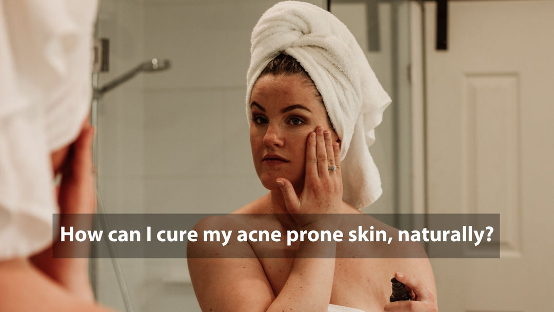 curing acne naturally