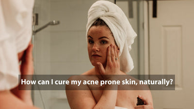 How can I cure my acne, naturally?
